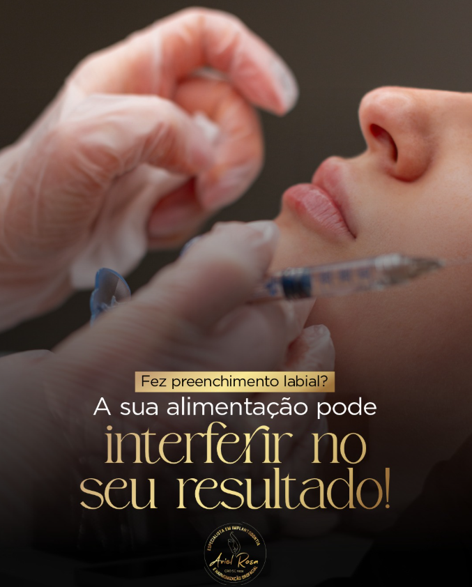 Antes e depois lentes de contato dental